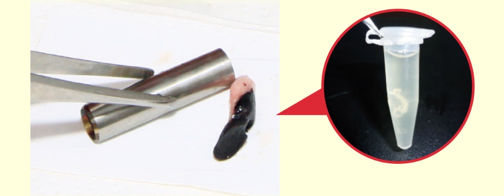 皮膚サンプル(左)と、取り出したDNAサンプル(右)