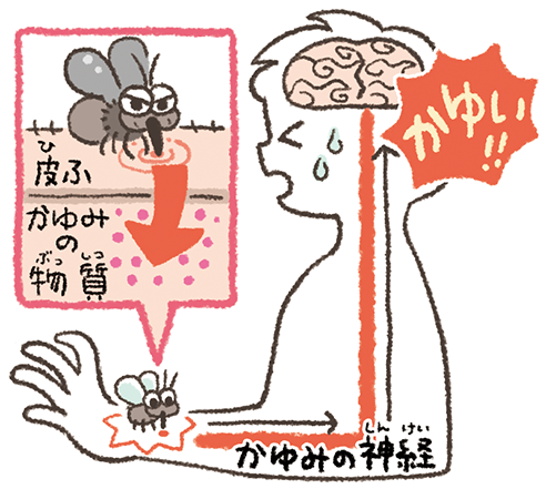 蚊にさされると どうしてかゆくなるの おしごとはくぶつかん