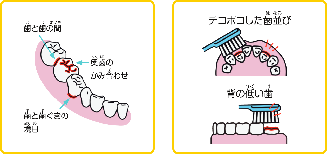 汚れがつきやすいところはどこ？