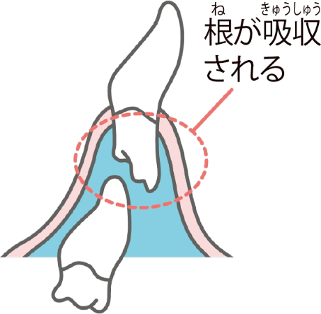 永久歯が根をつくり始めると、乳歯の根が少しずつ溶けていく