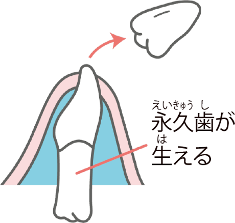 乳歯の根が溶けてなくなると、永久歯に押し出されて抜け落ち生え変わる