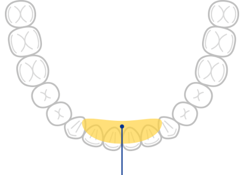 下の前歯の内側