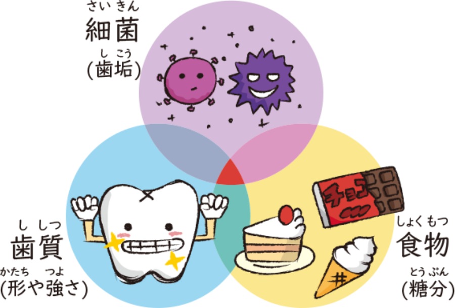 むし歯は三つの要因