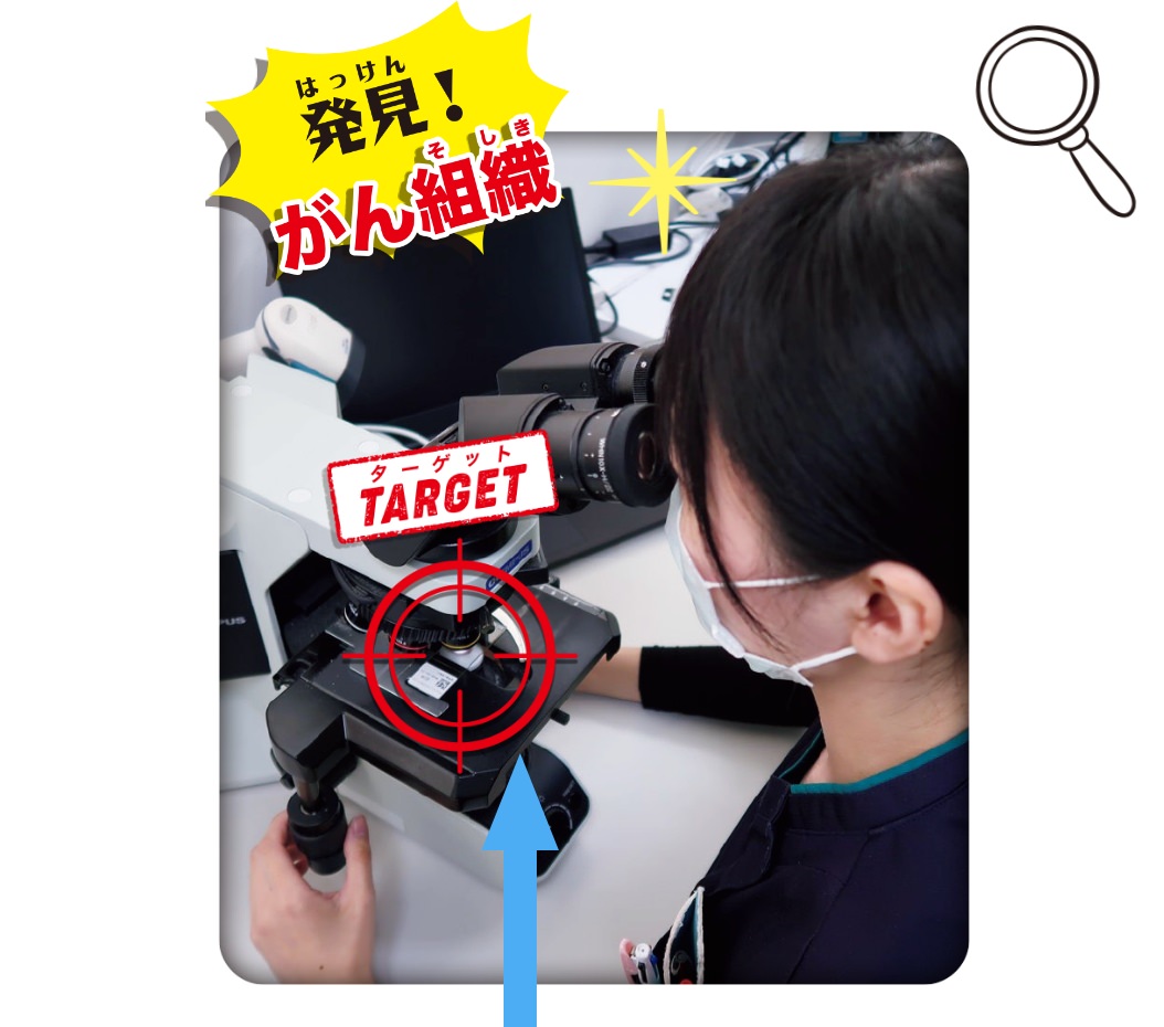 発見!がん組織