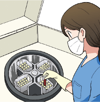 生化学検査